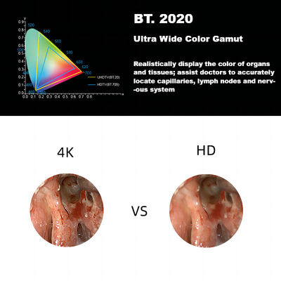 덱 복강경 검사를 위한 3840A 새로운 4K 울트라 HD 의학 내시경 카메라 시스템